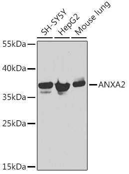 Anti-ANXA2 Antibody [KO Validated] (CAB1572)