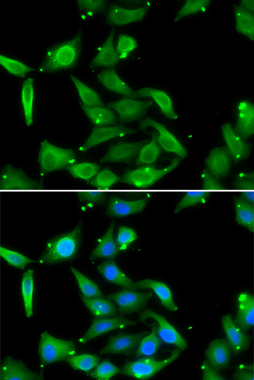 Anti-GAMT Antibody (CAB6597)