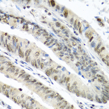 Anti-TIA1 Antibody (CAB12523)