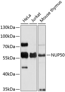 Anti-NUP50 Polyclonal Antibody (CAB9441)