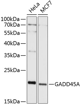 Anti-GADD45A Antibody (CAB11768)