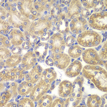 Anti-PSMD9 Antibody (CAB5357)