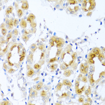 Anti-TDGF1 Antibody (CAB1065)