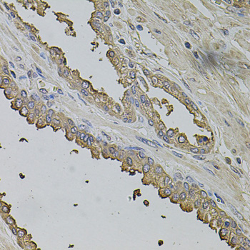 Anti-FMR1NB Antibody (CAB5183)