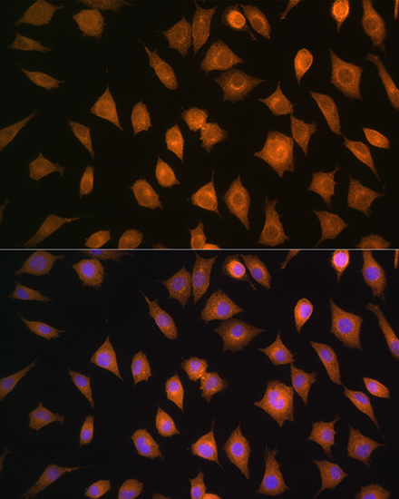 Anti-ELOVL4 Antibody (CAB3639)