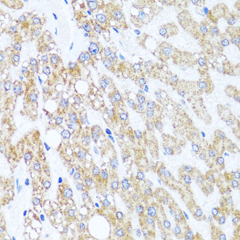 Anti-CHD1 Antibody [KO Validated] (CAB7883)