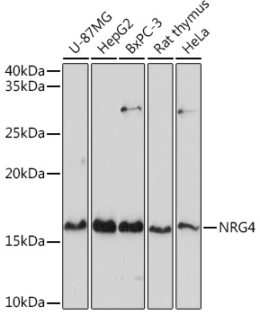 Anti-NRG4 Antibody (CAB2599)