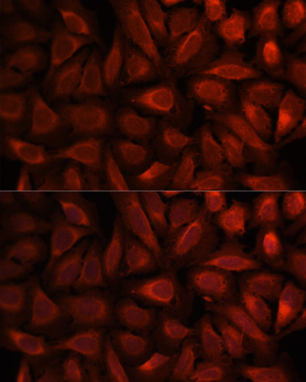 Anti-PEBP1 Antibody (CAB0578)