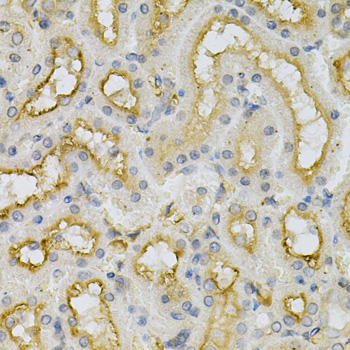 Anti-FHL1 Antibody (CAB5460)