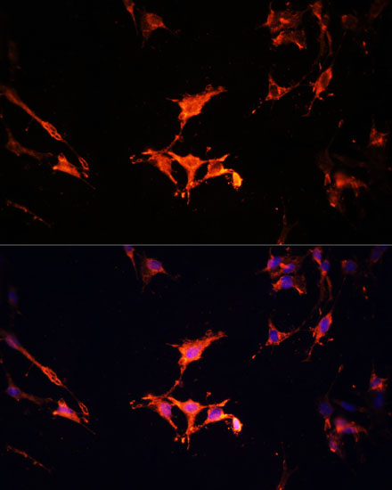 Anti-LAMTOR1 Antibody (CAB11619)