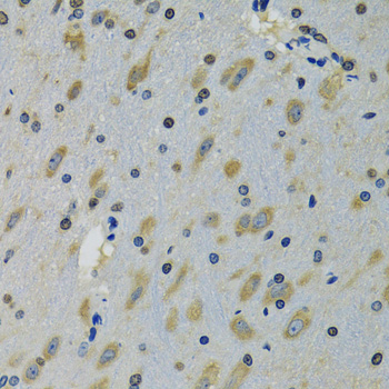 Anti-RPS12 Antibody (CAB5890)