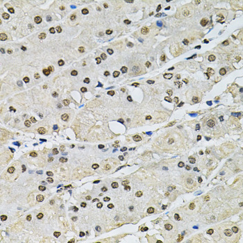 Anti-Histone H2A.Z Antibody [KO Validated] (CAB6614)