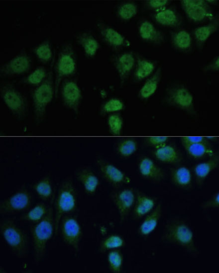 Anti-CPS1 Polyclonal Antibody (CAB8080)