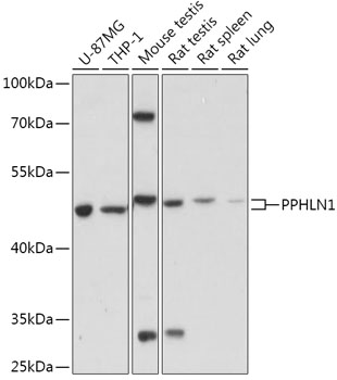 Anti-PPHLN1 Antibody (CAB17706)