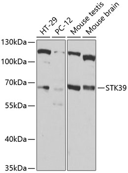 Anti-STK39 Polyclonal Antibody (CAB7974)