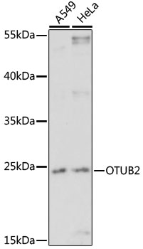 Anti-OTUB2 Antibody (CAB16251)