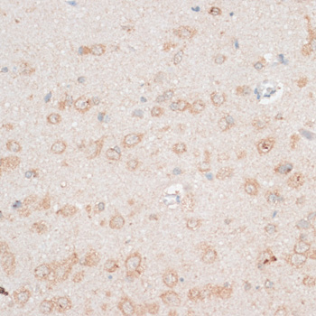 Anti-CDH18 Antibody (CAB14645)