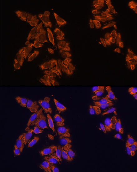 Anti-SIRPA Polyclonal Antibody (CAB9001)