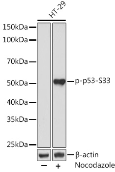 Anti-Phospho-p53-S33 Antibody (CABP0984)