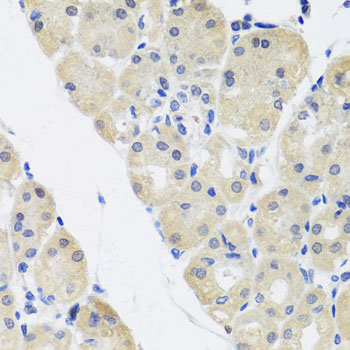 Anti-ALAD Polyclonal Antibody (CAB8398)