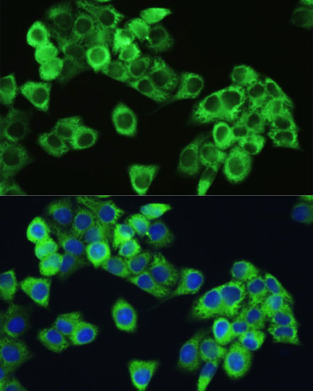 Anti-Phospho-mTOR-S2448 Antibody (CABP0094)