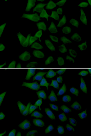 Anti-PLOD2 Antibody (CAB14045)