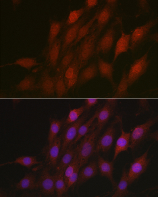 Anti-Beta-TRCP Antibody (CAB1656)