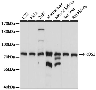 Anti-PROS1 Antibody (CAB1595)