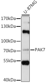 Anti-PAK5 Antibody (CAB15872)