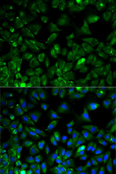 Anti-EEF2 Antibody (CAB0099)