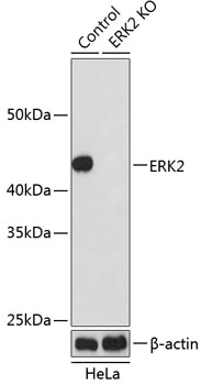 Anti-ERK2 Antibody [KO Validated] (CAB19630)