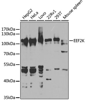 Anti-EEF2K Antibody [KO Validated] (CAB5404)