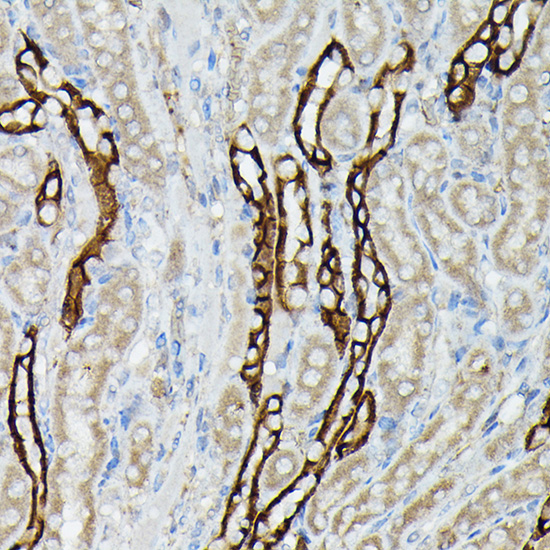 Anti-AQP3 Antibody (CAB2838)