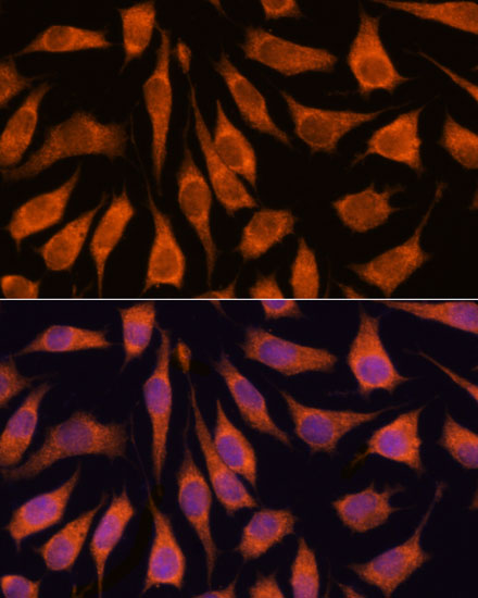 Anti-GOLPH3 Antibody (CAB13121)