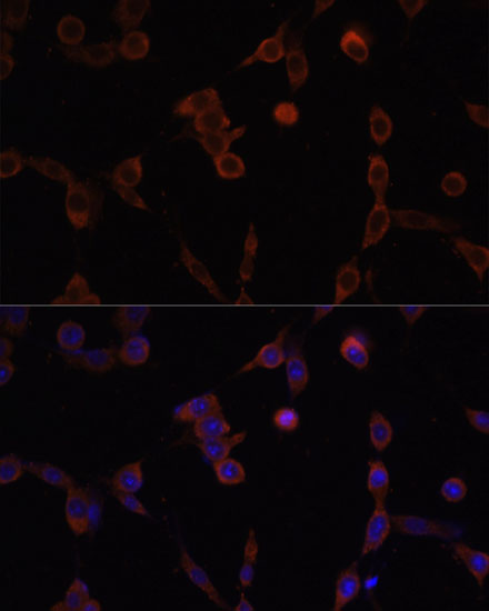 Anti-LAMP1 Antibody (CAB2582)