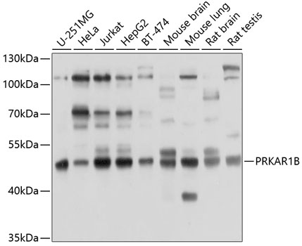 Anti-PRKAR1B Antibody (CAB10125)