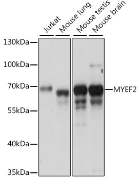 Anti-MYEF2 Antibody (CAB15829)