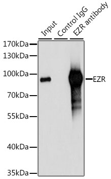 Anti-EZR Antibody (CAB0703)