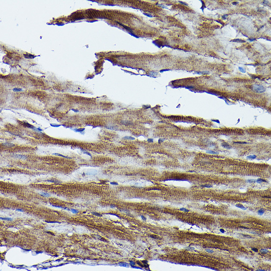 Anti-FXN / Frataxin Antibody (CAB1745)