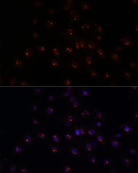 Anti-METTL16 Antibody (CAB15894)