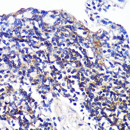 Anti-SWAP70 Antibody (CAB14857)