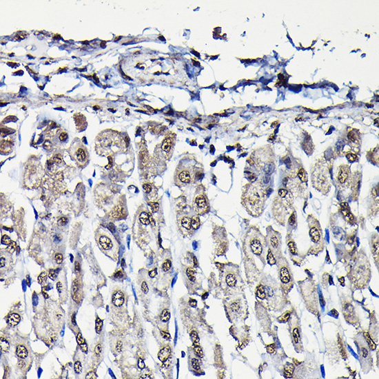 Anti-PFKFB3 Antibody (CAB6945)