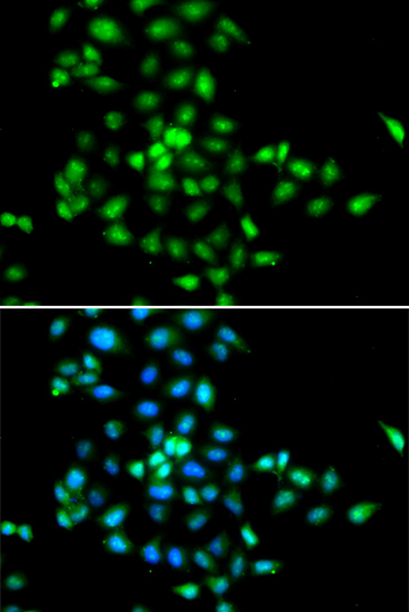 Anti-SBDS Antibody (CAB5876)