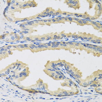 Anti-CST3 Antibody (CAB13291)