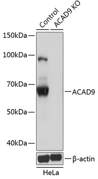 Anti-ACAD9 Antibody [KO Validated] (CAB19942)