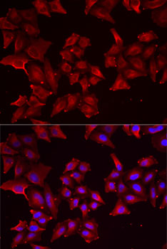 Anti-PCBD1 Antibody (CAB6392)