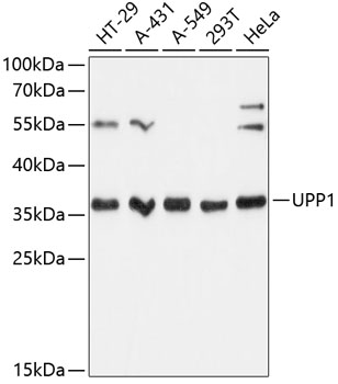 Anti-UPP1 Antibody (CAB13051)