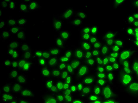 Anti-HNRNPD Antibody (CAB1828)