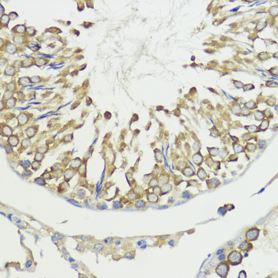 Anti-HACE1 Polyclonal Antibody (CAB9593)