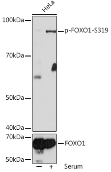 Anti-Phospho-FOXO1-S319 Antibody (CABP1090)